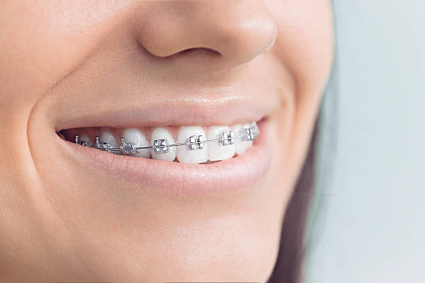 Best Teeth Whitening  in Gordon Heights, NY